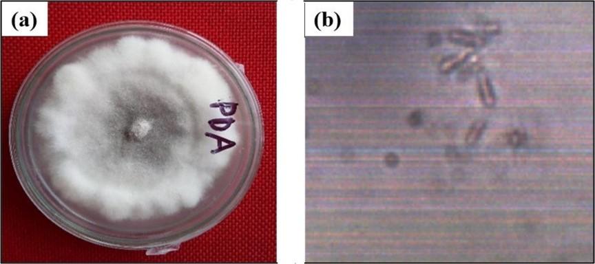 Detection and biological control measures of anthracnose causing fungus isolated from Citrus limon (L.)