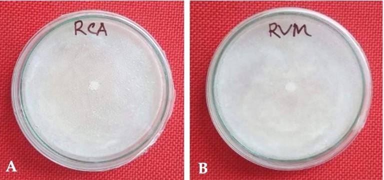 Detection and biological control measures of anthracnose causing fungus isolated from Citrus limon (L.)