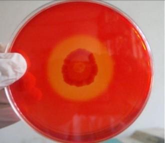 Isolation, documentation, and biochemical characterization of cellulolytic bacteria from rumen fluid of cattle