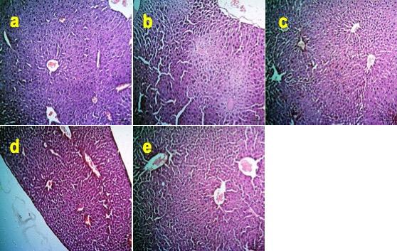 Restoration of hepatorenal dysfunction and injury by zinc and  folic acid combination in bisphenol A-intoxicated mice