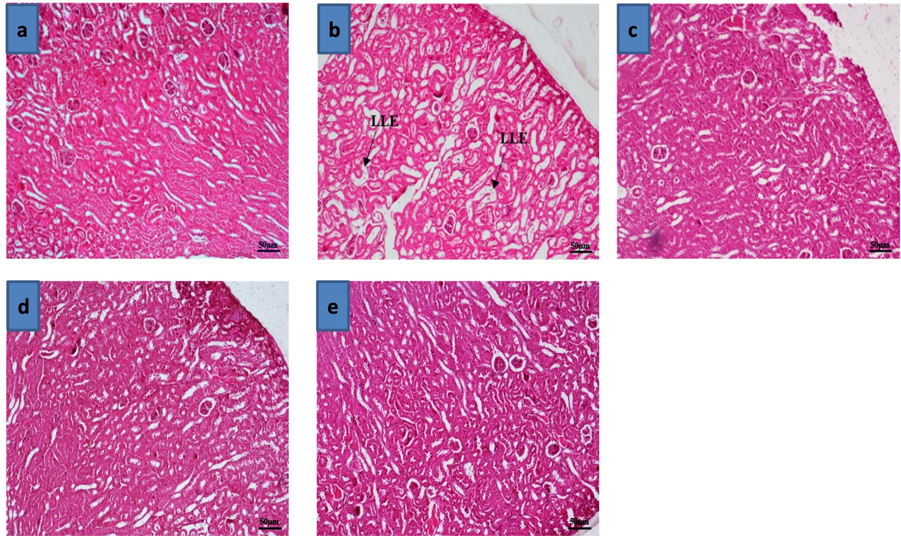 Restoration of hepatorenal dysfunction and injury by zinc and  folic acid combination in bisphenol A-intoxicated mice