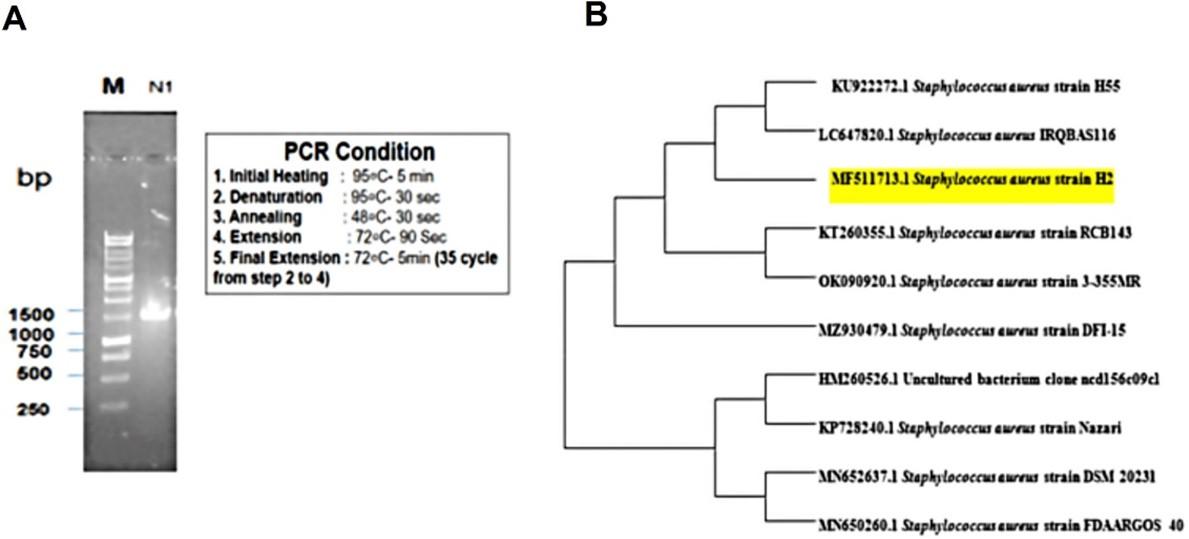 Biochemical and in silico study of leaf extract from Rumex dentatus against Staphylococcus aureus