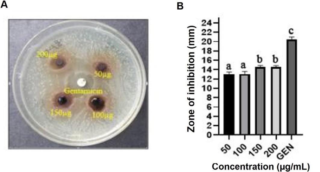 Biochemical and in silico study of leaf extract from Rumex dentatus against Staphylococcus aureus