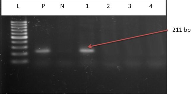 Isolation and identification of Salmonella spp. and Escherichia coli from water used during live transportation of Pangasius catfish, Pangasianodon hypophthalmus