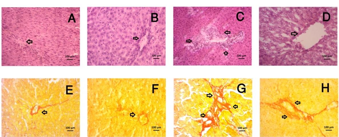 Ramipril, an angiotensin-converting enzyme inhibitor ameliorates oxidative stress, inflammation, and hepatic fibrosis in alloxan-induced diabetic rats