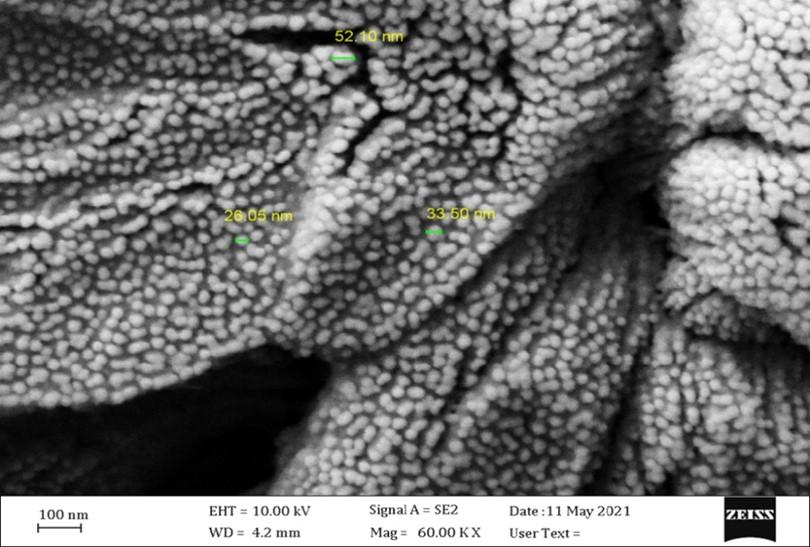 Protective effect of L-carnitine nanoparticles Vs carnitine on lead acetate-induced toxicity in male rats