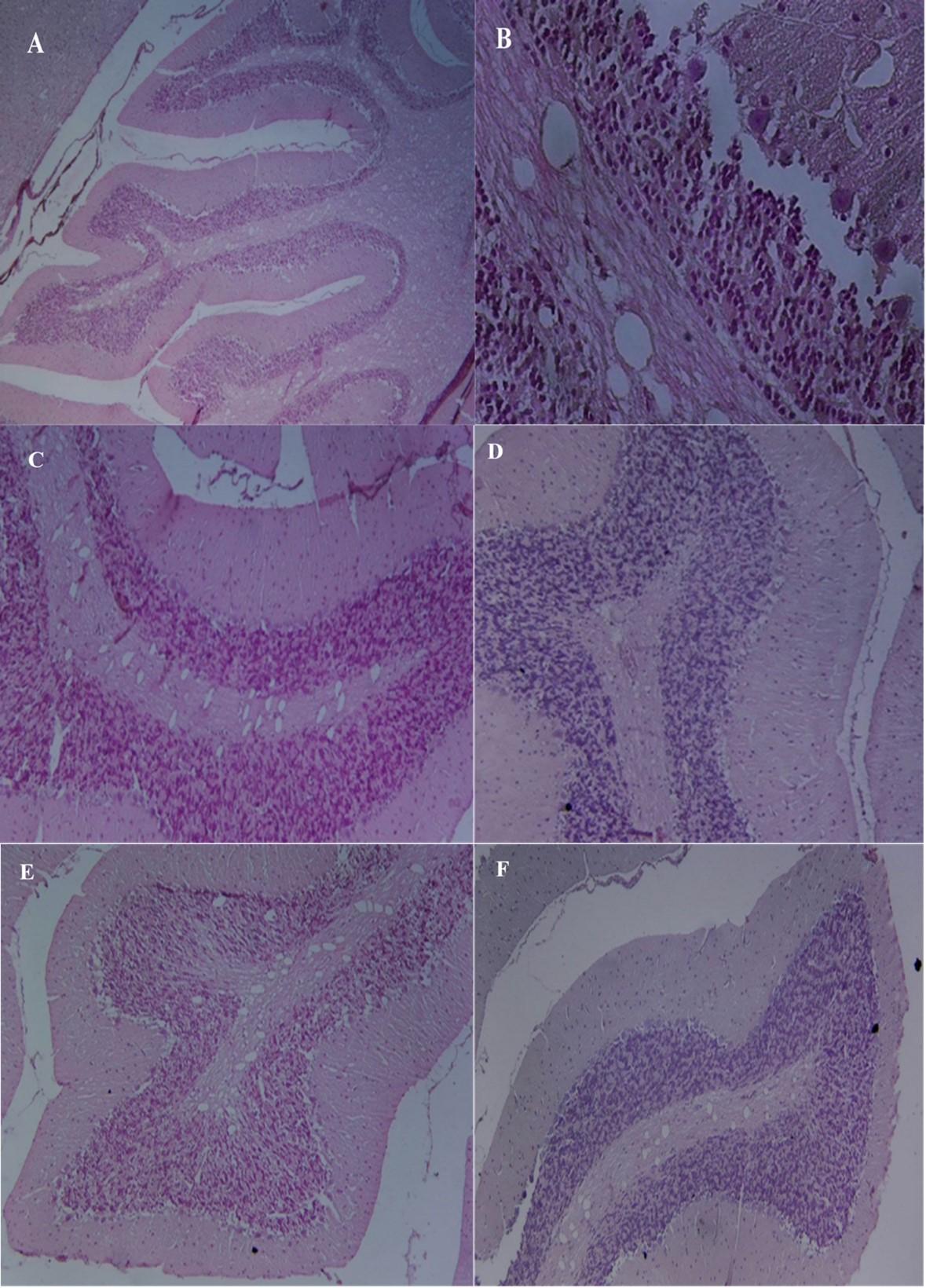 Protective effect of L-carnitine nanoparticles Vs carnitine on lead acetate-induced toxicity in male rats