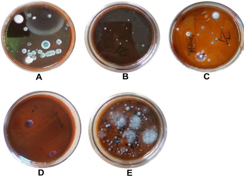 Aspergillus niger grows faster than Escherichia coli in eosin methylene blue media and deter their growth by reducing the pH of the media