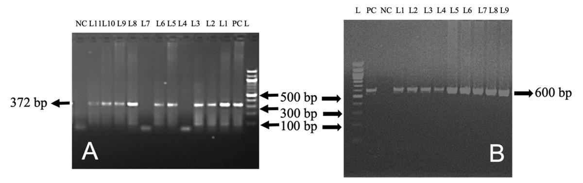 Pathological investigation and molecular detection of bacterial zoonotic diseases of slaughtered cattle in Bangladesh