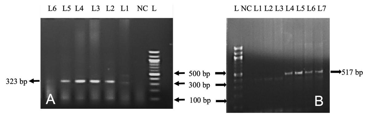 Pathological investigation and molecular detection of bacterial zoonotic diseases of slaughtered cattle in Bangladesh