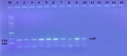 Effect of gentamicin and doxycycline on expression of relB and relE genes in Klebsiella pneumonia