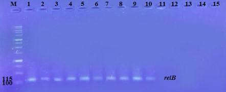 Effect of gentamicin and doxycycline on expression of relB and relE genes in Klebsiella pneumonia