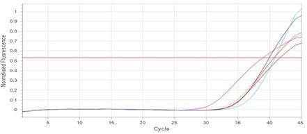 Effect of gentamicin and doxycycline on expression of relB and relE genes in Klebsiella pneumonia