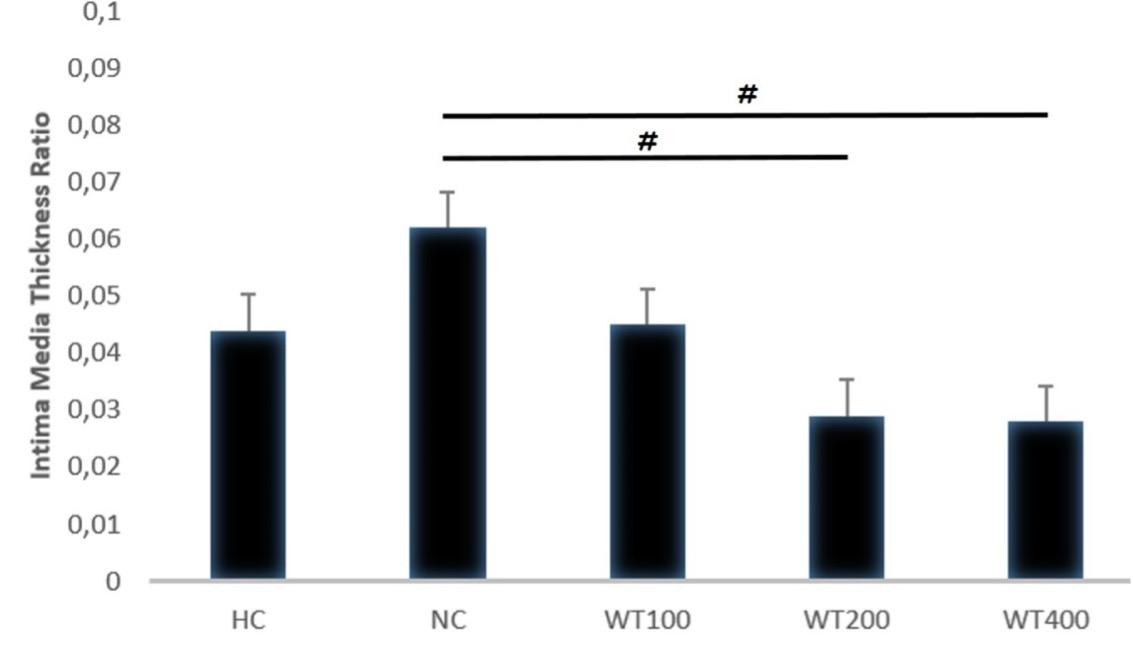 Effect of white tea (Camellia sinensis) leaf extract on cigarette smoke and high-fat diet-induced atherosclerosis in Wistar rats