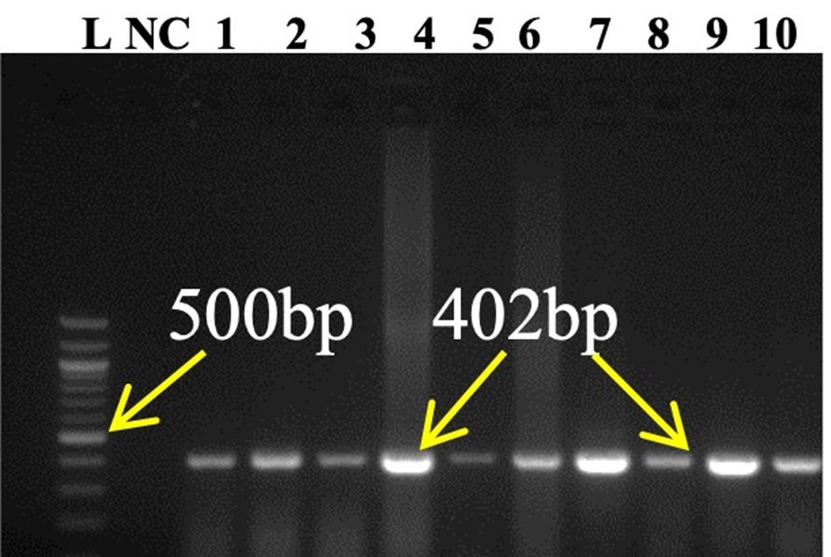 Validation and standardization of designed N gene primer-based RT-PCR protocol for detecting Peste des Petits Ruminants virus in goats