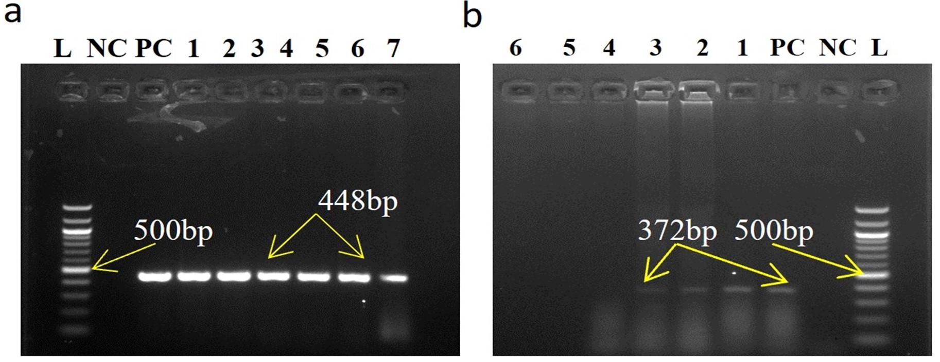 Validation and standardization of designed N gene primer-based RT-PCR protocol for detecting Peste des Petits Ruminants virus in goats