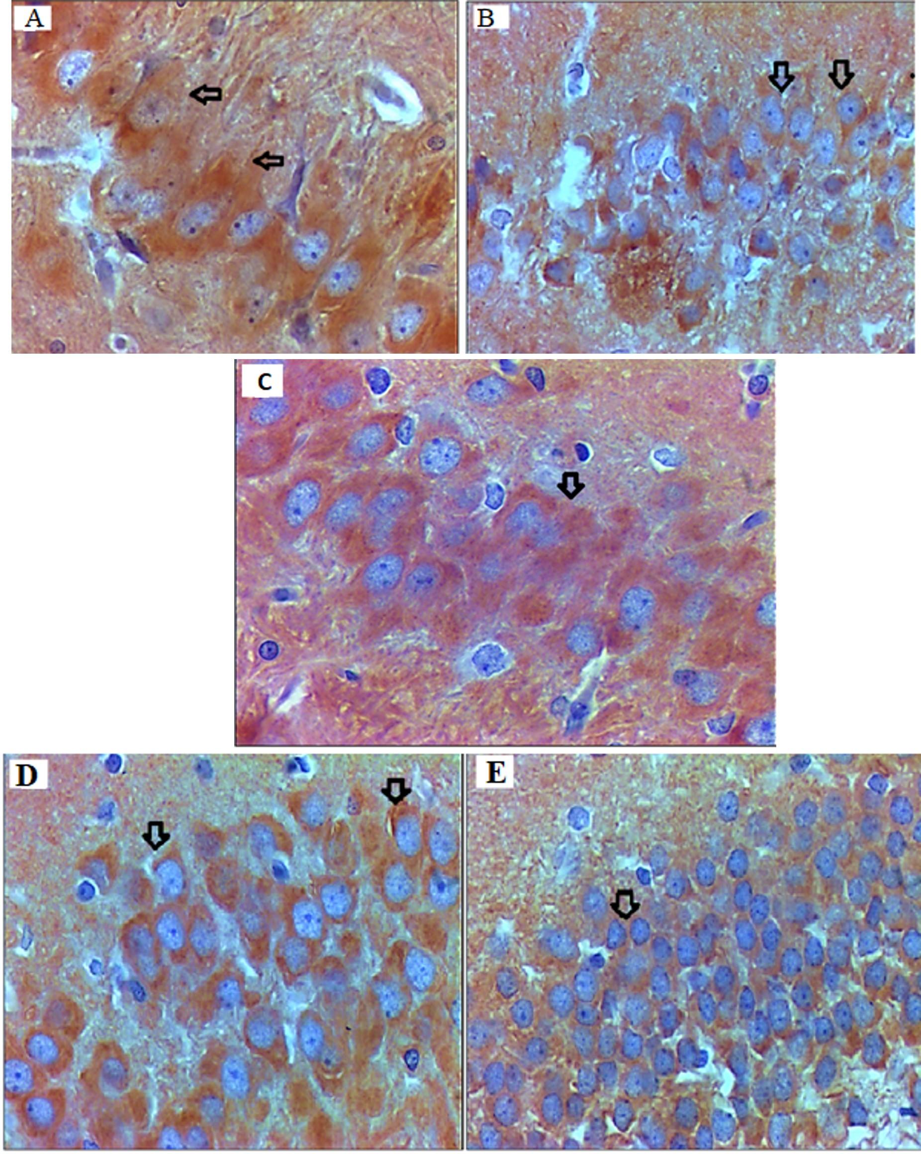 <span>Ocimum basilicum</span> extract modulates Tau aggregation and improves memory function in a neurodegenerative rat model