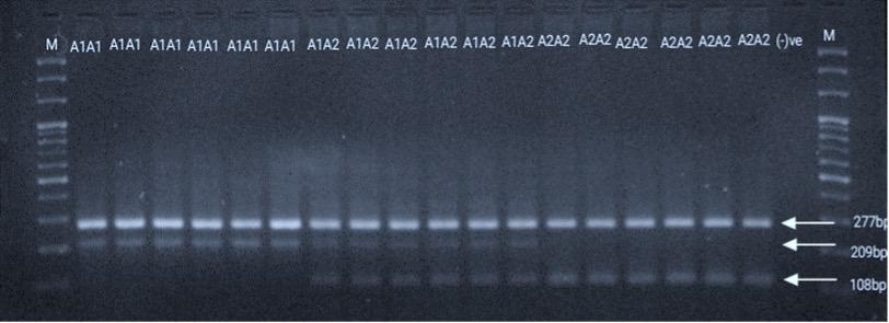 Analysis of β-casein gene for A1 and A2 allelic variants in Holstein-Local crossbred cattle of Bangladesh using allele-specific PCR