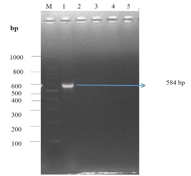 Molecular characterization of multidrug-resistant bacteria isolated from the external and internal parts of the housefly