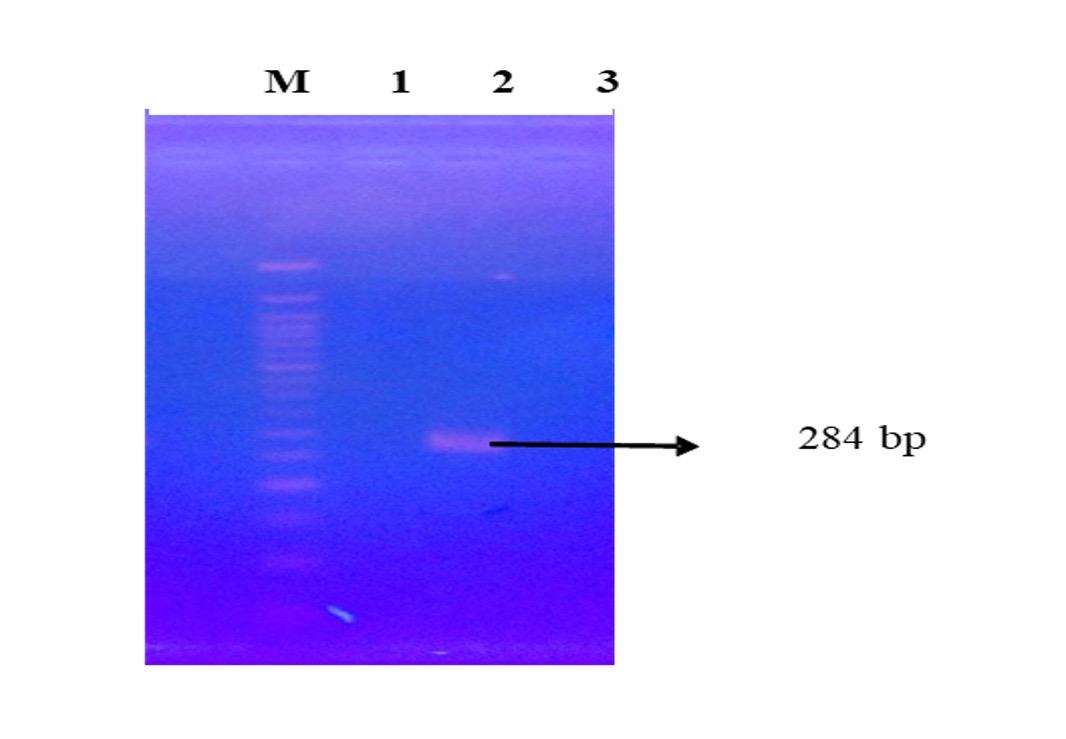 Molecular characterization of multidrug-resistant bacteria isolated from the external and internal parts of the housefly