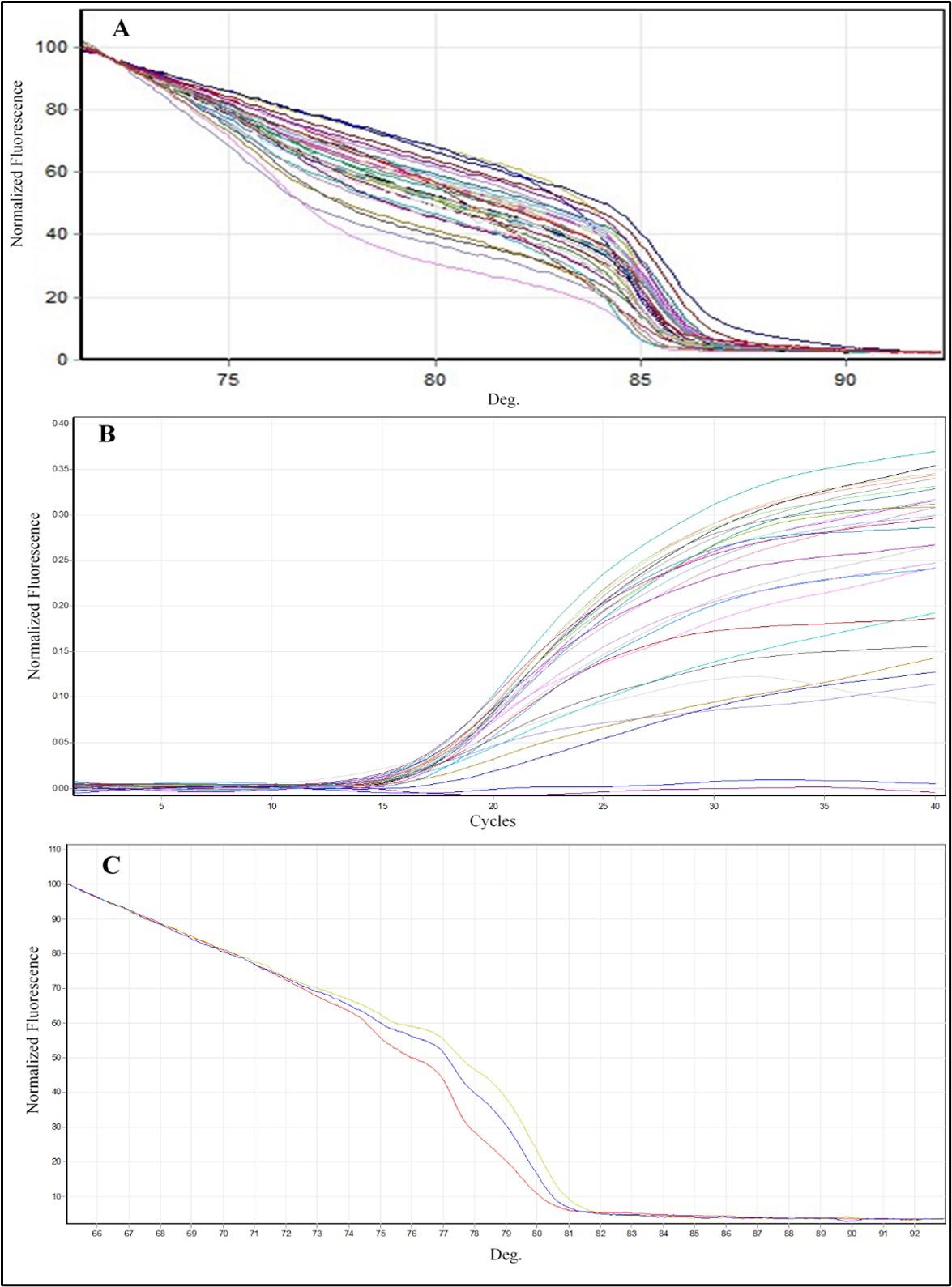 Effect of KISS1 gene variants (rs372790354 G>A and rs4889 G>A) on kisspeptin in patients with polycystic ovary syndrome in Iraq