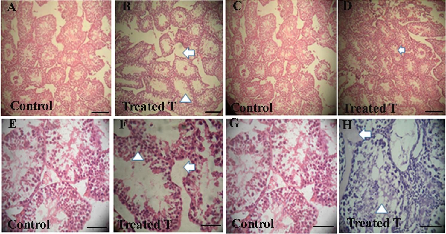 Herbal contraceptive effect of Abrus precatorius, Ricinus communis, and Syzygium aromaticum on anatomy of the testis of male Swiss albino mice