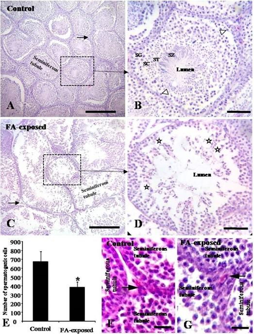 Formaldehyde-contaminated feed induces histopathological changes in the testes of adult pigeons (Columba livia)