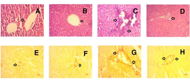 HMG-CoA reductase inhibitor, rosuvastatin averted carbon tetrachloride-induced oxidative stress, inflammation and fibrosis in the liver of rats