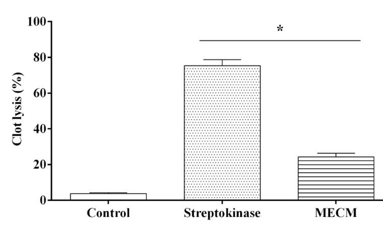 Phytochemical screening and in vitro pharmacological activities of methanolic leaves extract of Caryota mitis