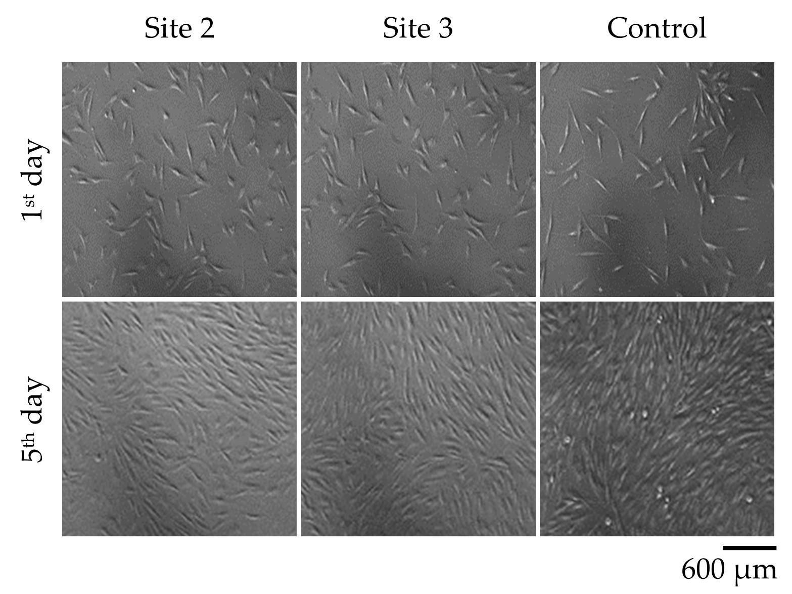 Evaluation of the effectiveness of low-level laser therapy on proliferation of fibroblasts isolated from chronic wounds in human in vitro