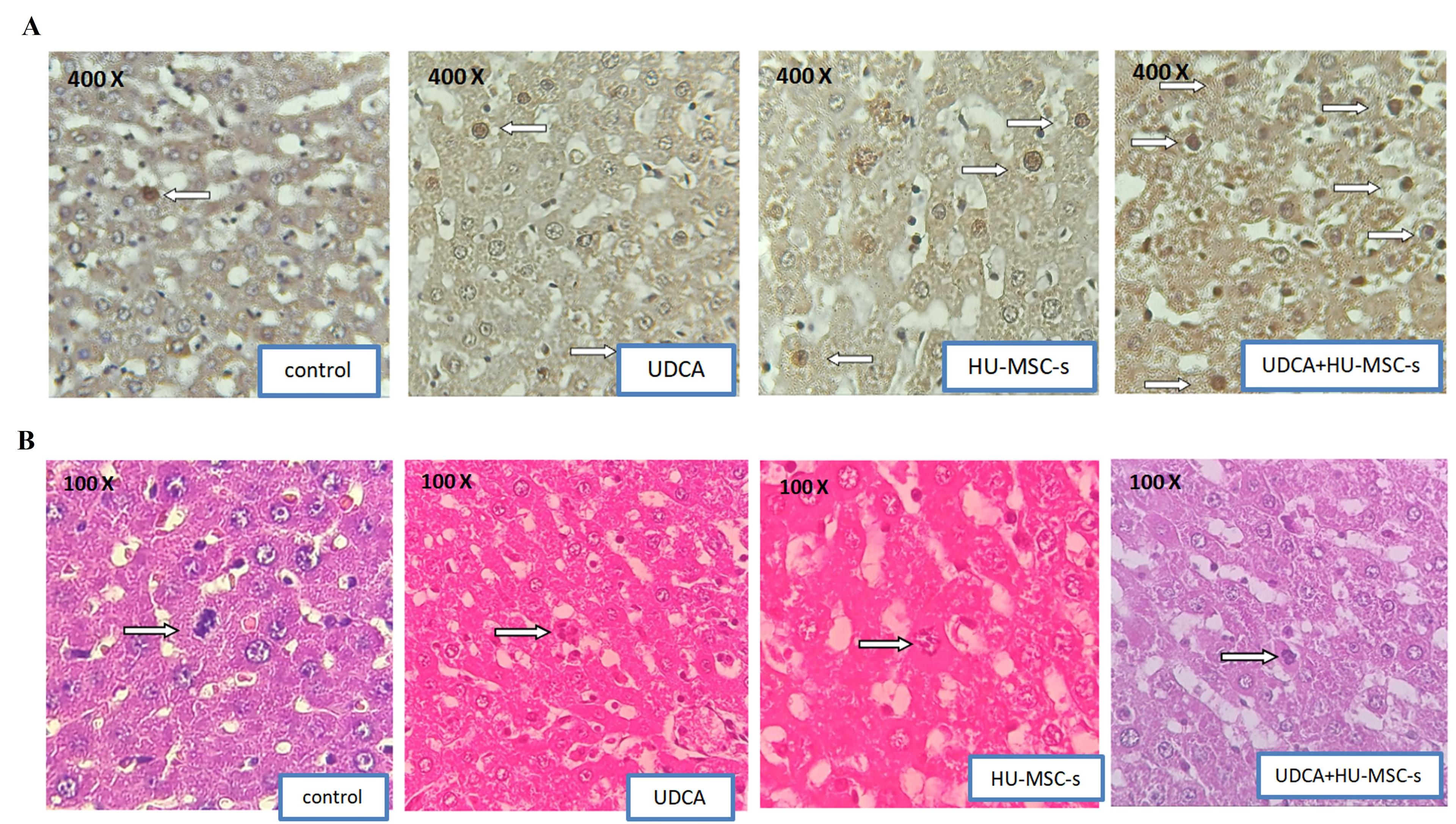 Human mesenchymal stem cell secretome increases hepatocyte growth factor expression and promotes liver regeneration in Wistar rats with cholestasis