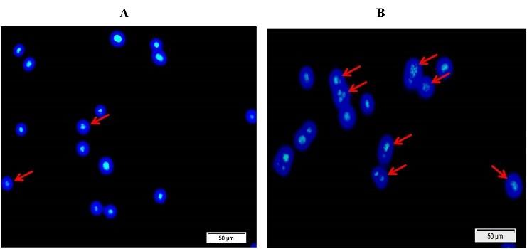 Methanolic extract of Moringa oleifera leaves mediates anticancer activities through inhibiting NF-𝜅B and enhancing ROS in Ehrlich ascites carcinoma cells in mice