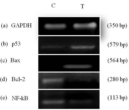 Methanolic extract of Moringa oleifera leaves mediates anticancer activities through inhibiting NF-𝜅B and enhancing ROS in Ehrlich ascites carcinoma cells in mice