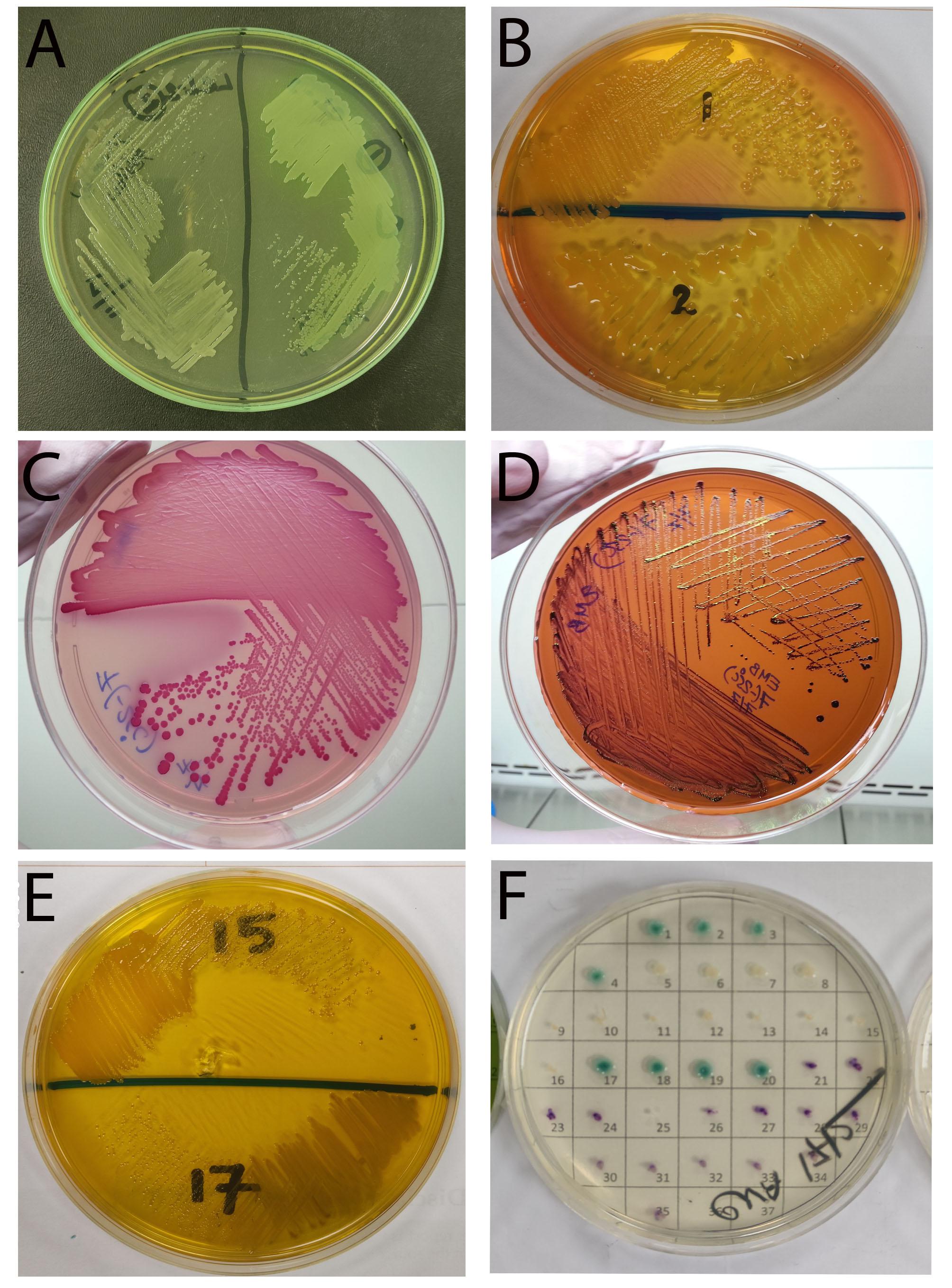 Occurrence of multi-antibiotic resistant bacteria isolated from food handlers’ hands and utensils at different restaurants in Dhaka, Bangladesh