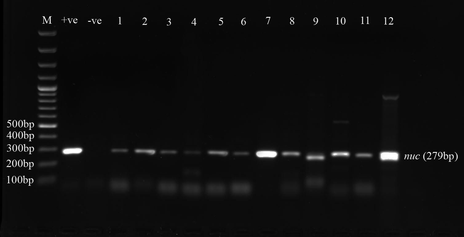 Occurrence of multi-antibiotic resistant bacteria isolated from food handlers’ hands and utensils at different restaurants in Dhaka, Bangladesh