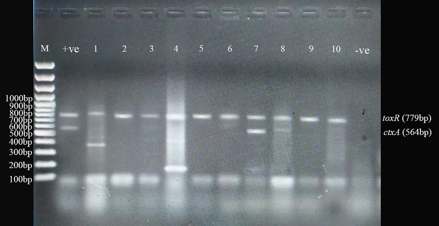 Occurrence of multi-antibiotic resistant bacteria isolated from food handlers’ hands and utensils at different restaurants in Dhaka, Bangladesh