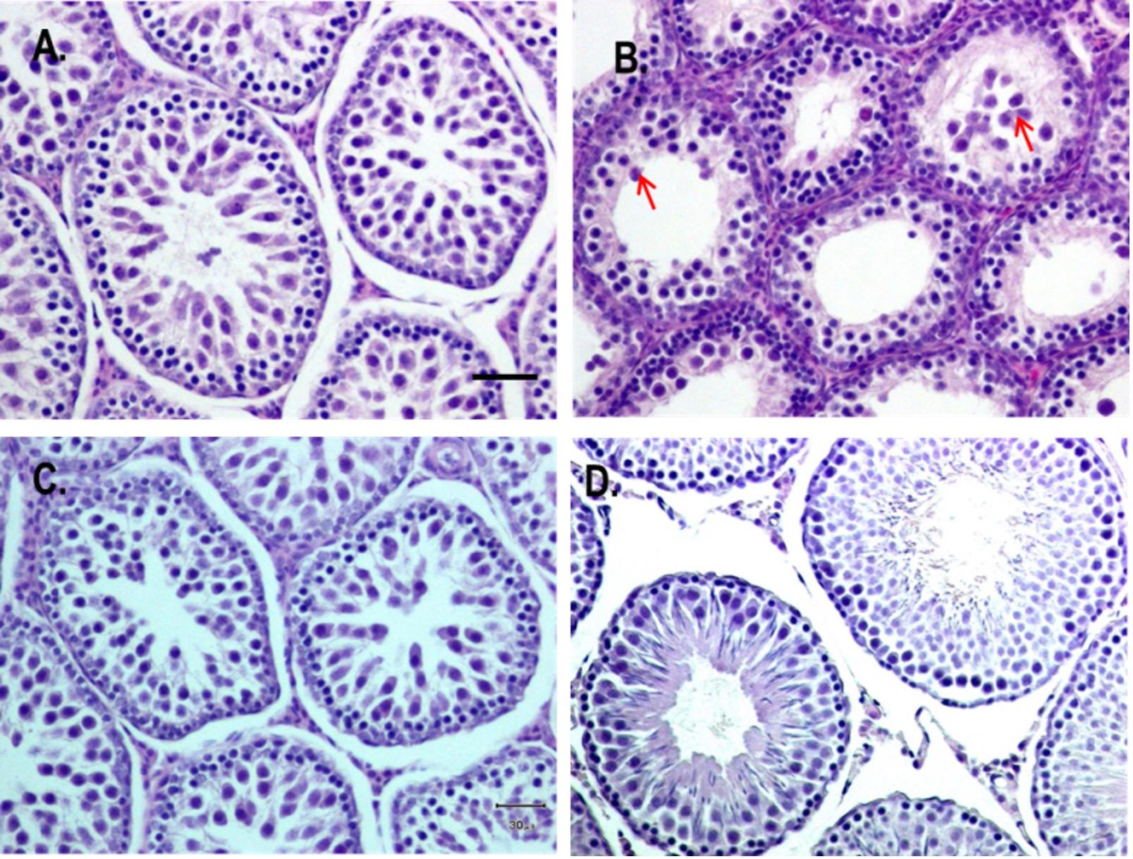 Prophylactic effects of vitamin E and selenium on di (n-butyl) phthalate-induced testicular damage in prepubertal rats