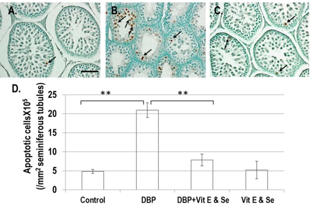 Prophylactic effects of vitamin E and selenium on di (n-butyl) phthalate-induced testicular damage in prepubertal rats