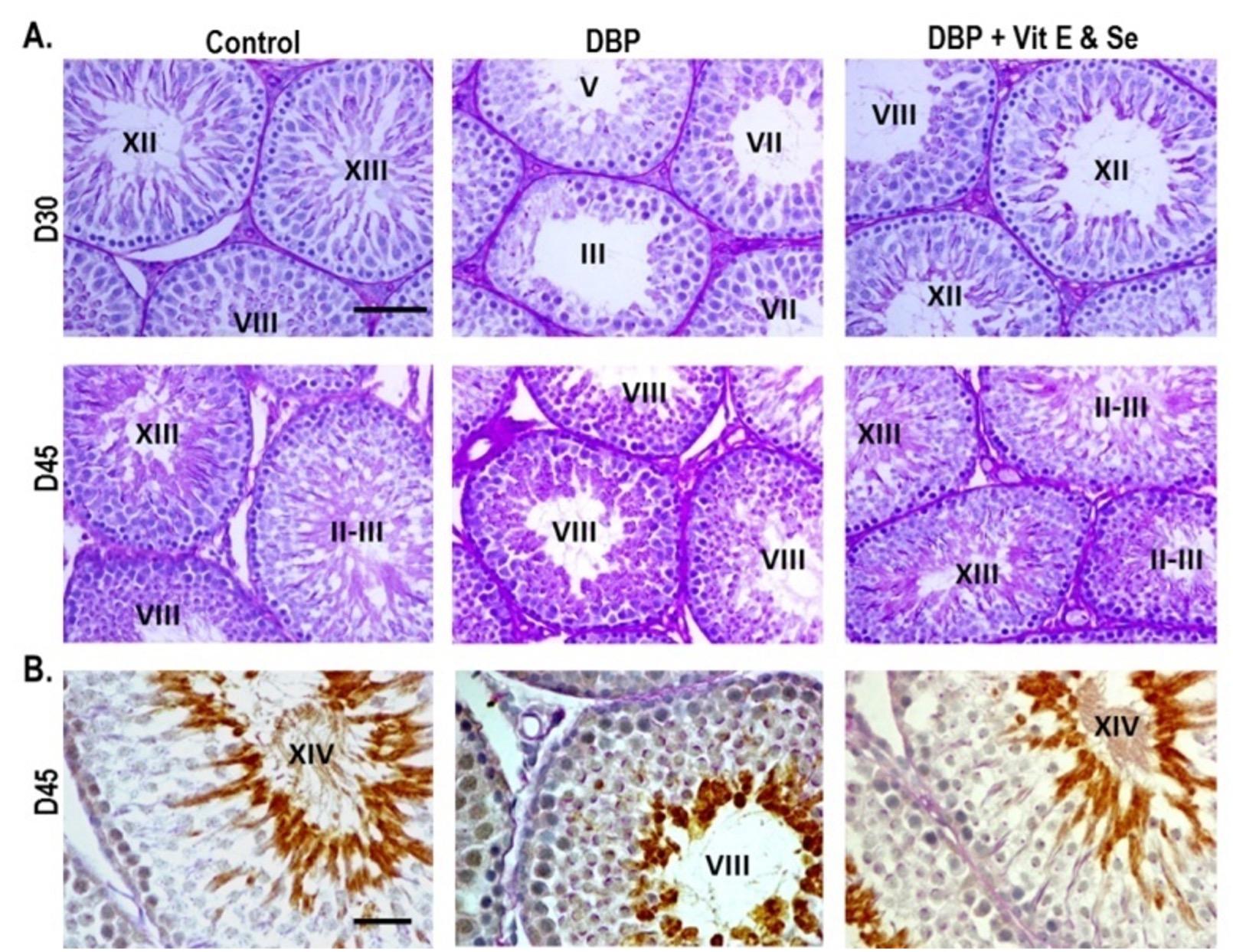 Prophylactic effects of vitamin E and selenium on di (n-butyl) phthalate-induced testicular damage in prepubertal rats