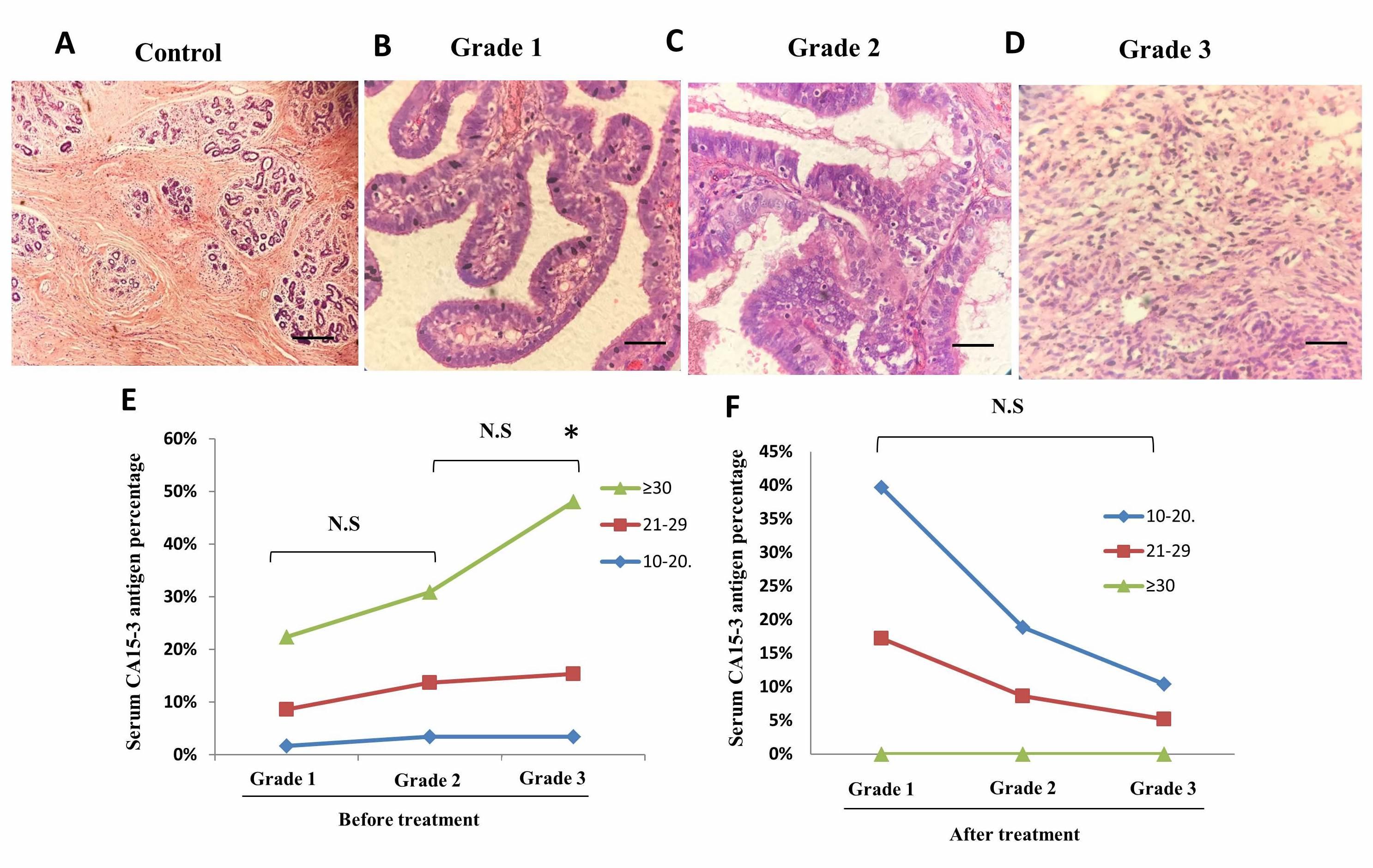 Association of neutrophils, monocytes, and lymphocytes with CA15-3 as a predictor of breast cancer in female patients