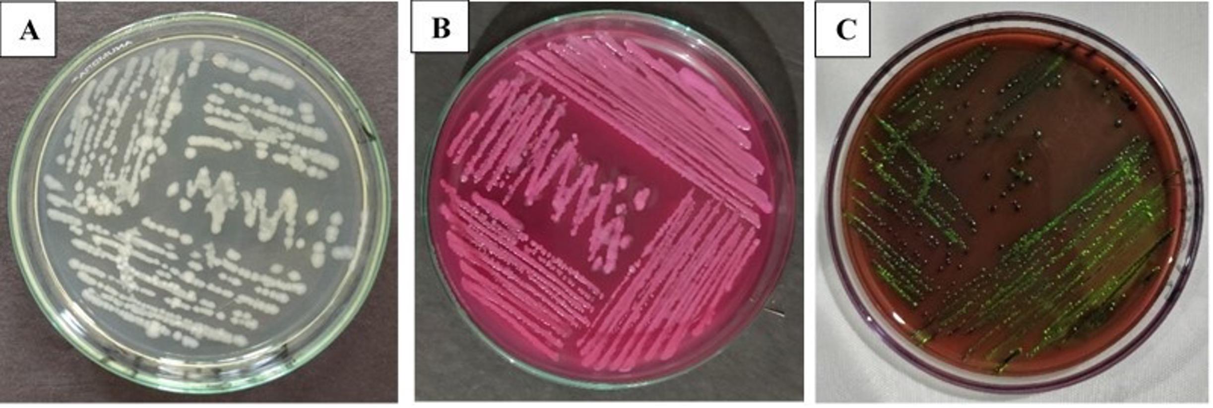 Characterization of <span>tetA</span> gene of <span>Escherichia coli</span>  isolated from colibacillosis affected calves in Rangpur, Bangladesh