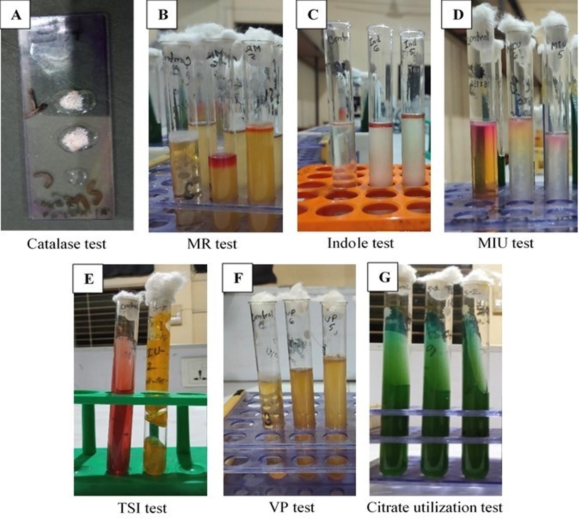 Characterization of <span>tetA</span> gene of <span>Escherichia coli</span>  isolated from colibacillosis affected calves in Rangpur, Bangladesh