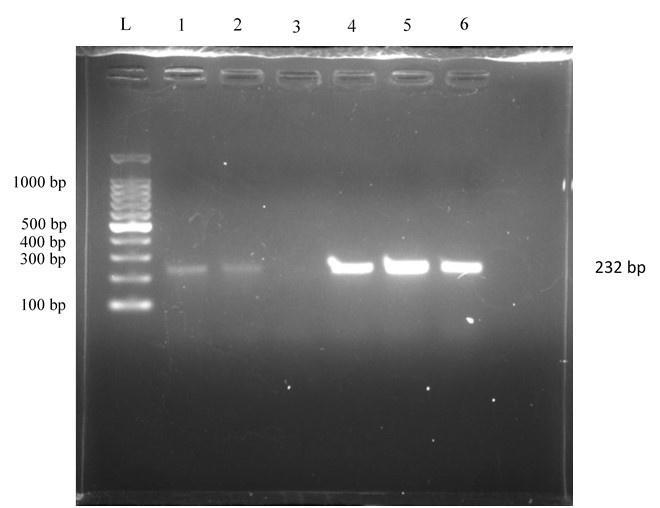 Characterization of <span>tetA</span> gene of <span>Escherichia coli</span>  isolated from colibacillosis affected calves in Rangpur, Bangladesh