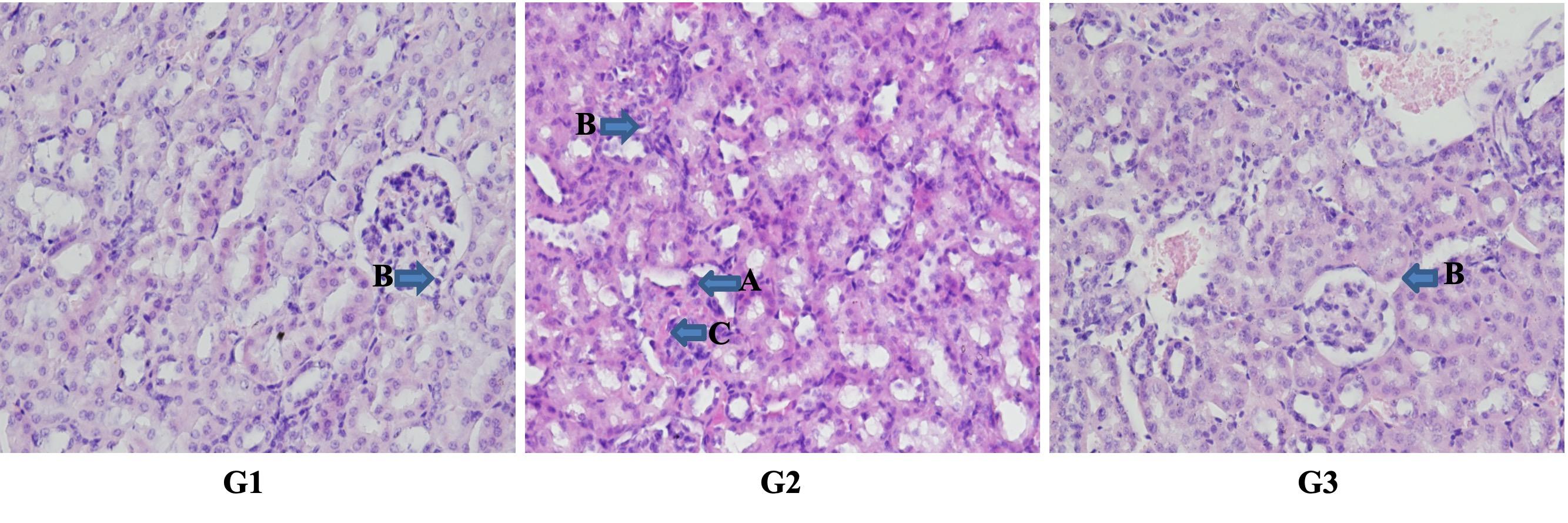 Hyperbaric oxygen as an immunosuppressant in mouse model of lupus nephritis