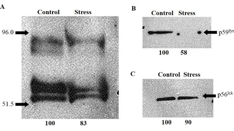 Tyrosine phosphorylation related to thymic involution induced by diet restriction in comparison with aging