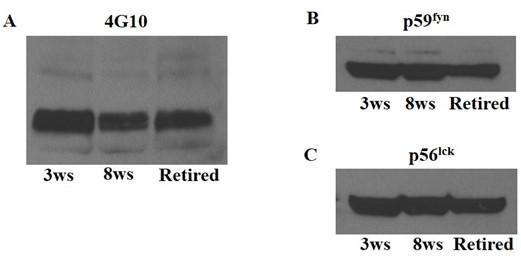 Tyrosine phosphorylation related to thymic involution induced by diet restriction in comparison with aging