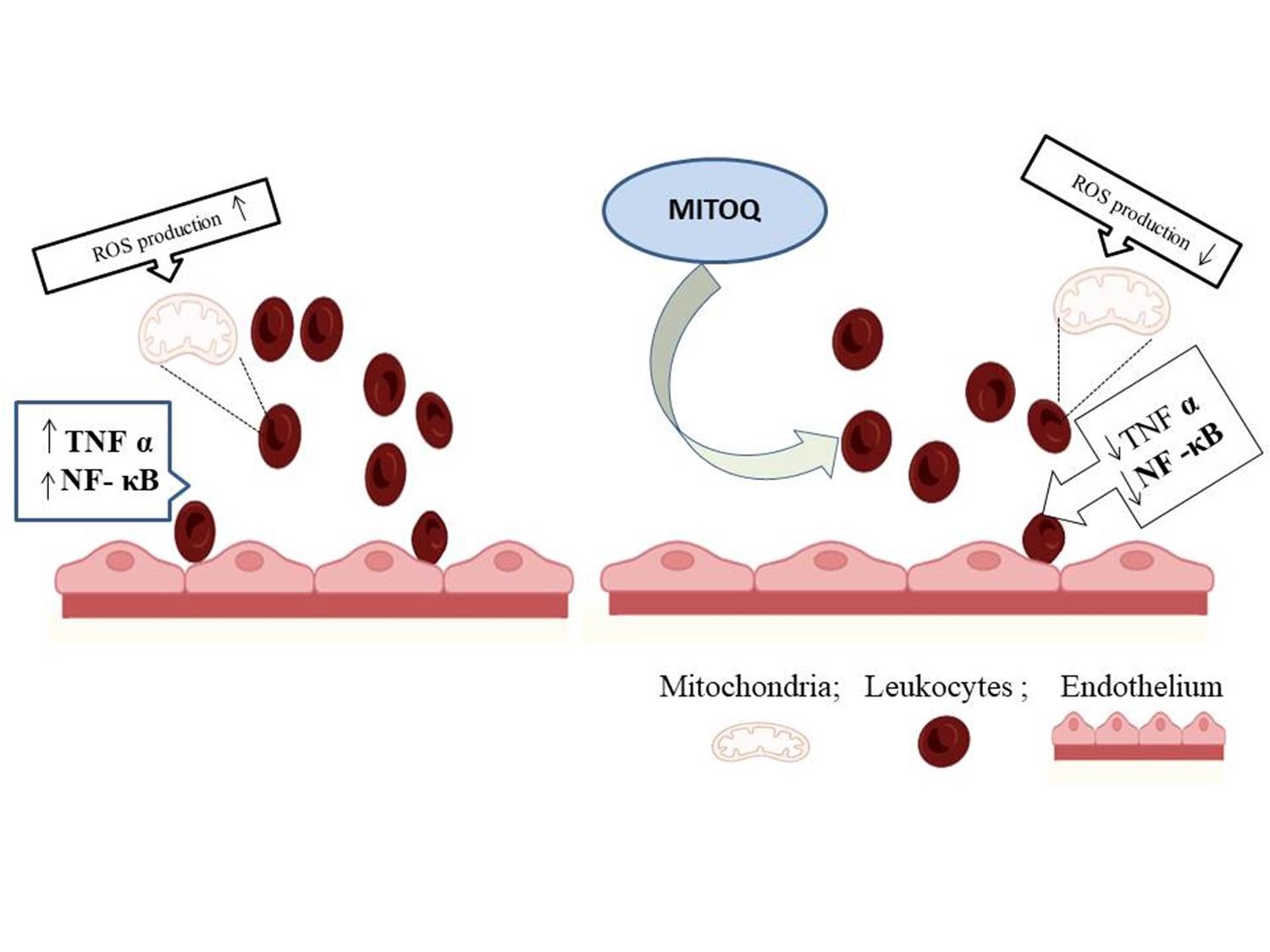 Tracing mitochondrial dysfunction pathways in type 2 diabetes: The promise of mitochondria-targeted therapeutics