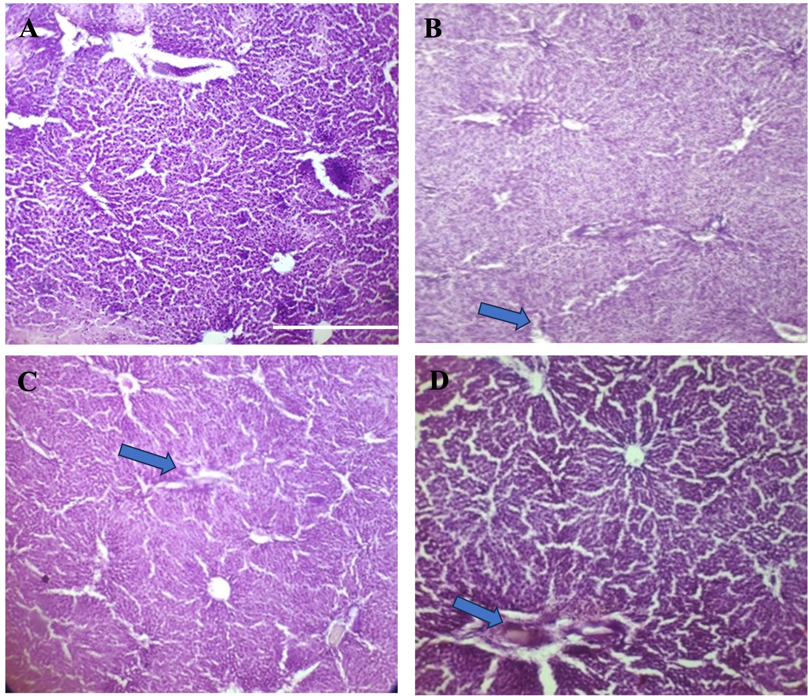 Effect of <span>Gynura procumbens</span> leaf extract with biological nanoparticles on streptozotocin-induced hyperglycemia in a rat model