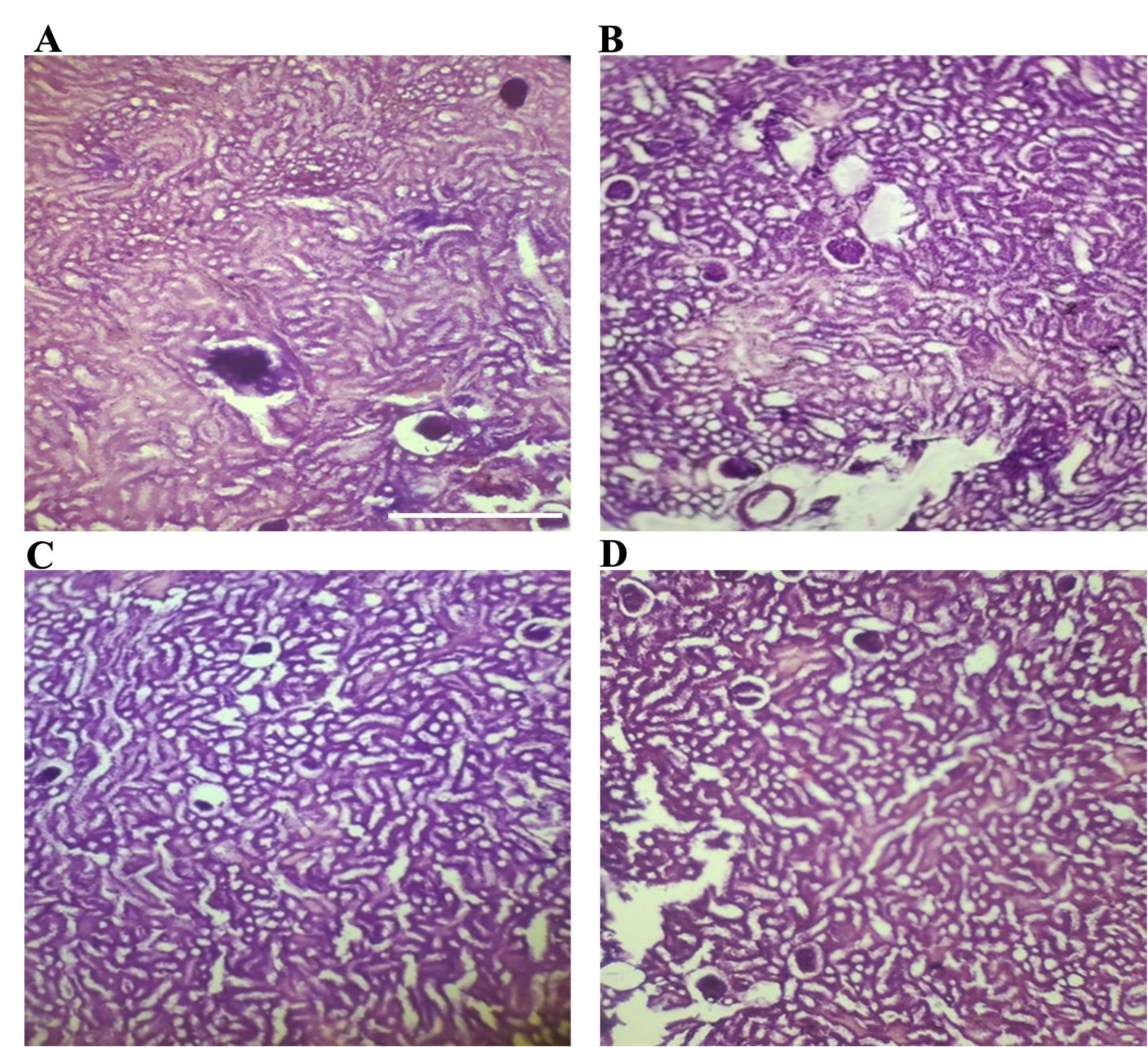 Effect of <span>Gynura procumbens</span> leaf extract with biological nanoparticles on streptozotocin-induced hyperglycemia in a rat model