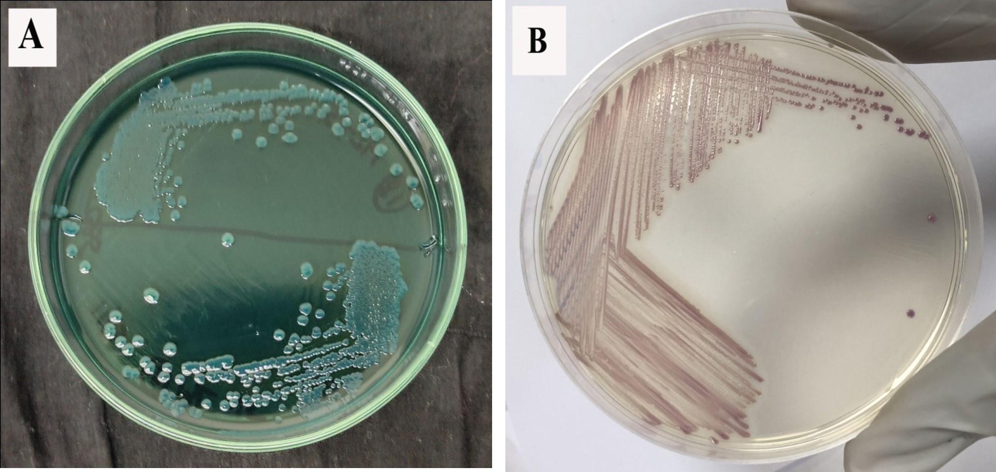 Detection of multi-antibiotic resistant  <span>Vibrio parahaemolyticus</span> isolated from fresh produce in Dhaka, Bangladesh